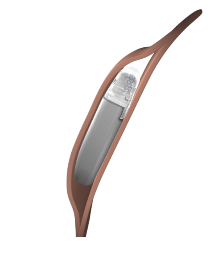 Evera MRI XT DR и Evera MRI S DR